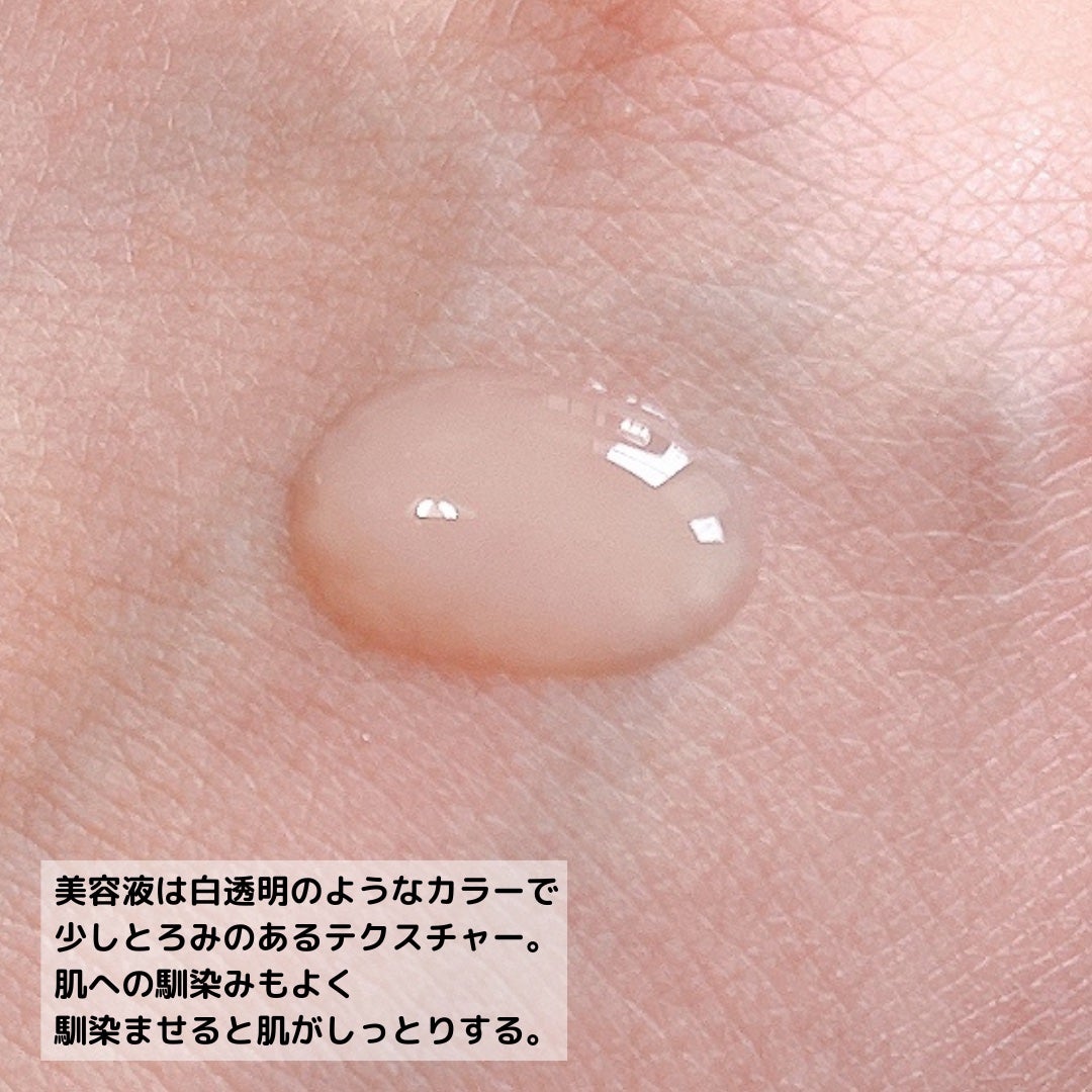 モイストケア ローション MB/d プログラム/化粧水を使ったクチコミ(6枚目)