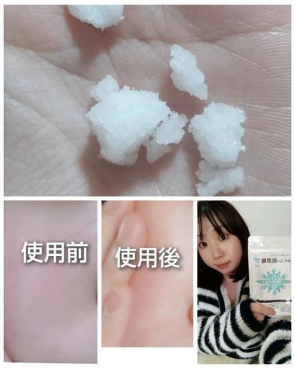 みんなの肌潤糖~クリアタイプ~/北の快適工房/その他スキンケアを使ったクチコミ(3枚目)