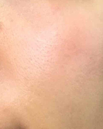 Alami アラミーオイル/La・Katy/フェイスオイルを使ったクチコミ(3枚目)