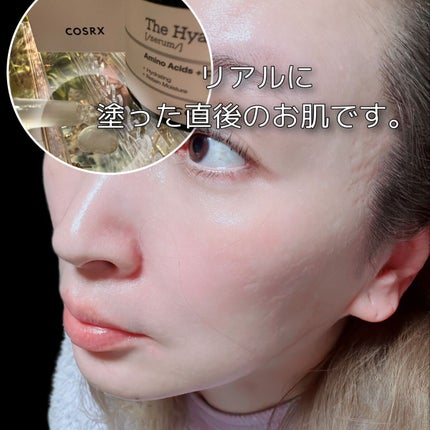 RXザ・ヒアルロン酸3セラム /COSRX/美容液を使ったクチコミ(4枚目)