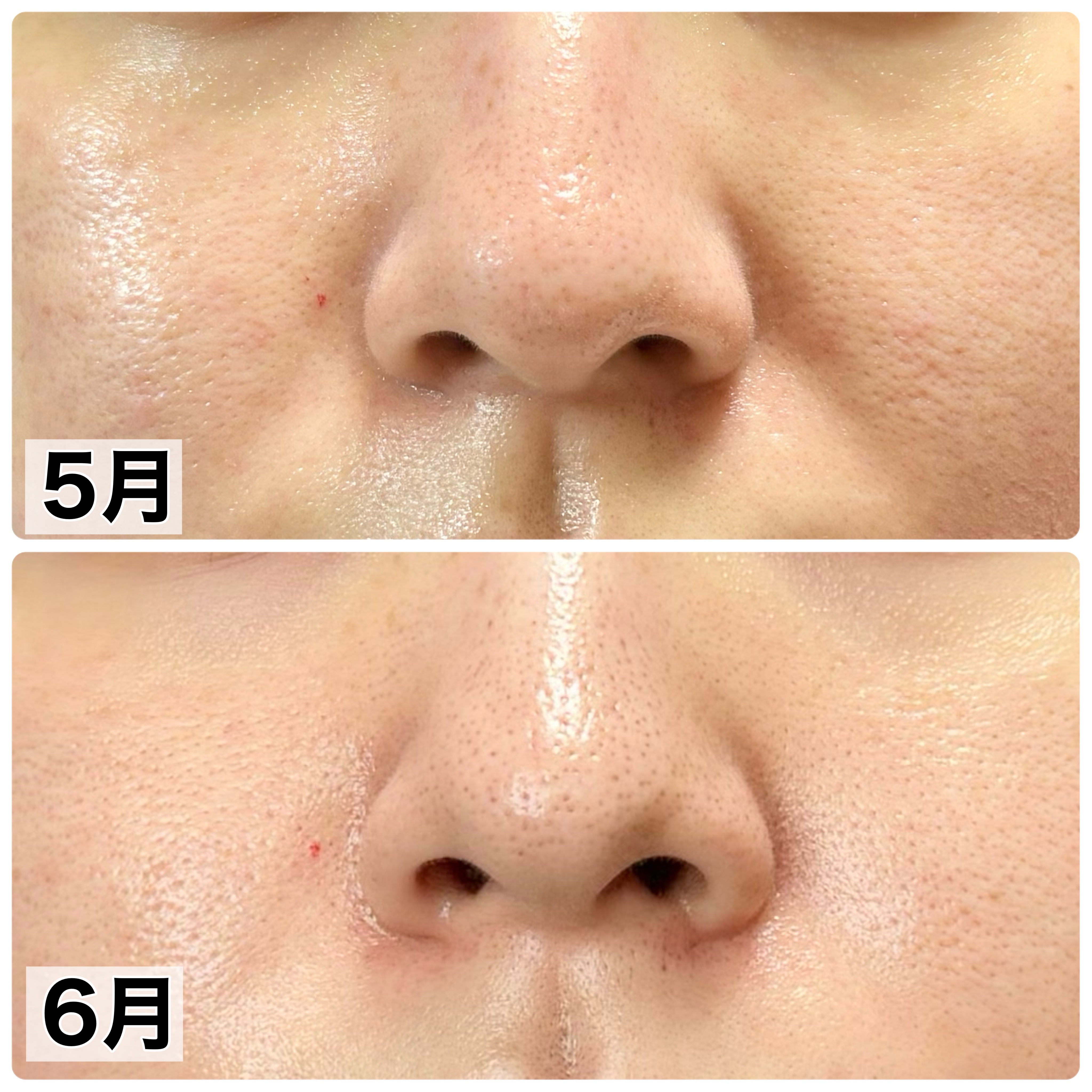 ニベア２ＷＡＹ美容洗顔/ニベア/洗顔フォームを使ったクチコミ（2枚目）