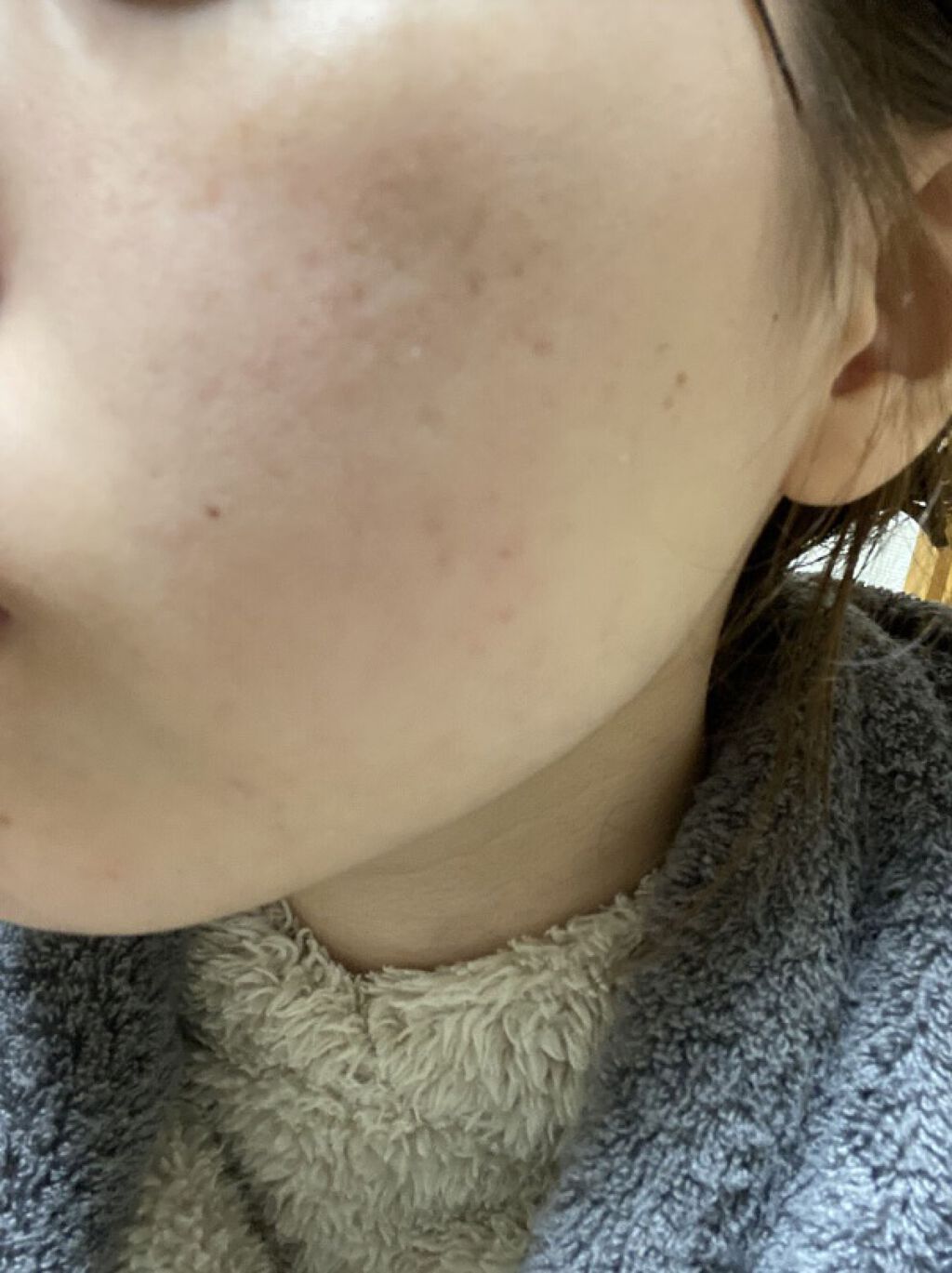 ビジャ ローション/innisfree/乳液を使ったクチコミ（3枚目）