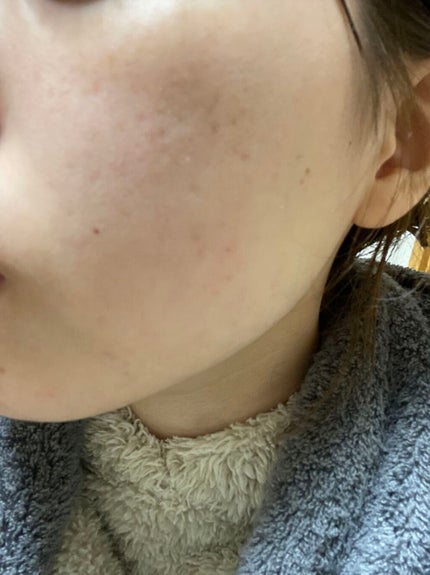 ビジャ ローション/innisfree/乳液を使ったクチコミ(3枚目)