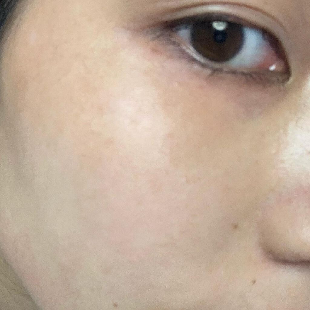 non♡ on LIPS 「・@whiterush_hq様の美白化粧水バクチアモイスチャー..」(3枚目)