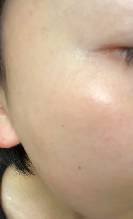 プレミアムトリートメントマスク/SUIKO HATSUCURE/シートマスク・パックを使ったクチコミ(5枚目)