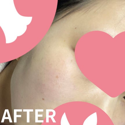 フェイスパウダー/DECORTÉ/ルースパウダーを使ったクチコミ(6枚目)