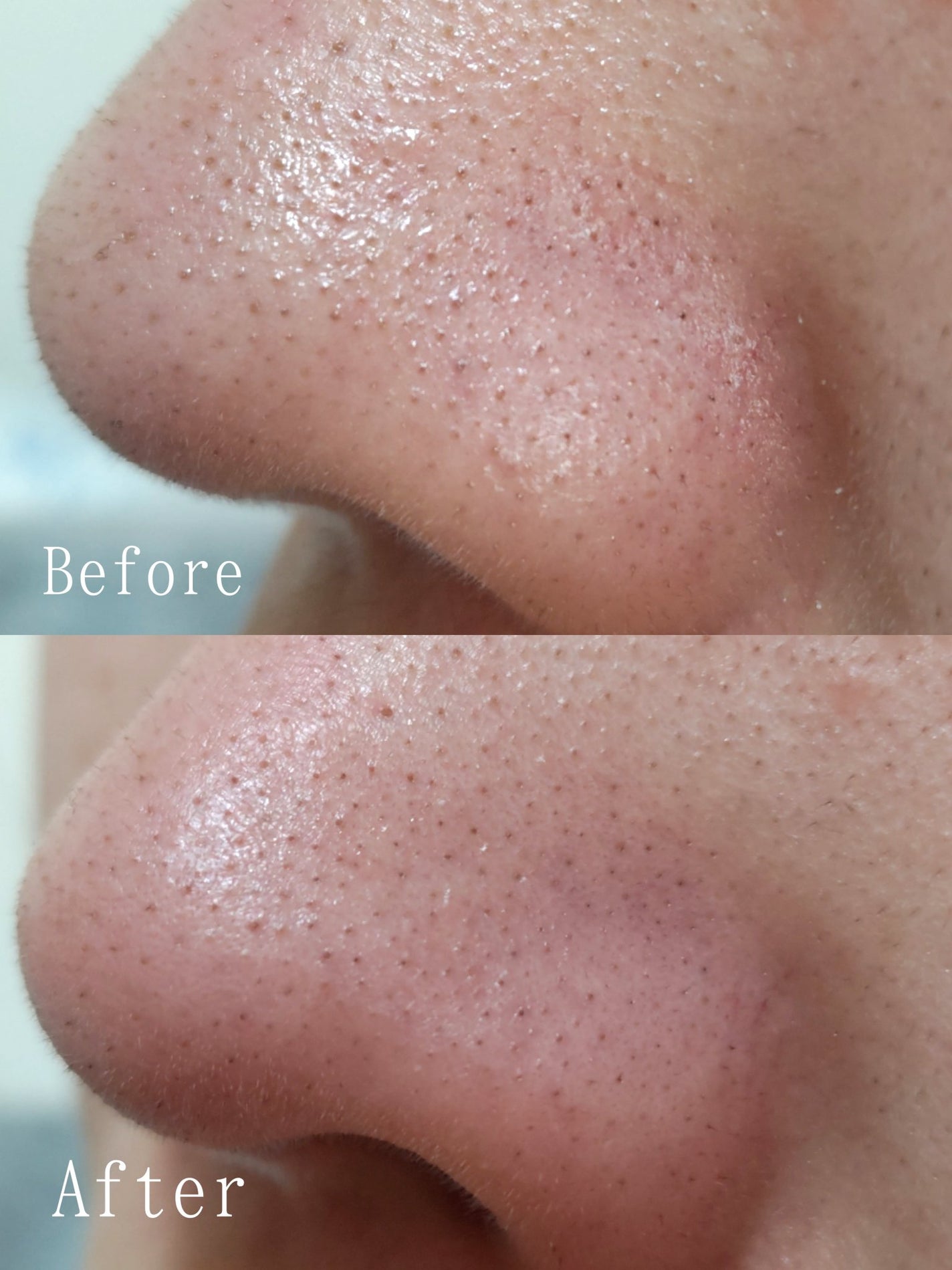 マイルドクレンジング オイル/ファンケル/オイルクレンジングを使ったクチコミ(4枚目)