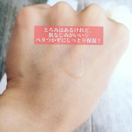 オルビスユー ローション/オルビス/化粧水を使ったクチコミ(4枚目)