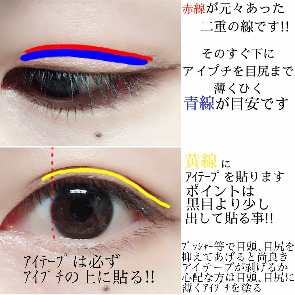 のびーるアイテープ(絆創膏タイプ、レギュラー)/DAISO/二重まぶた用アイテムを使ったクチコミ(2枚目)