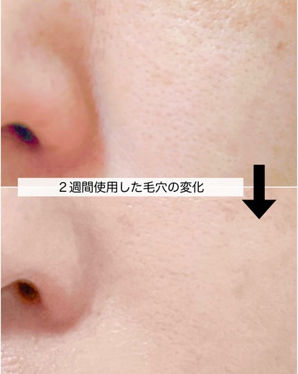 リードルショット100/VT/美容液を使ったクチコミ(6枚目)