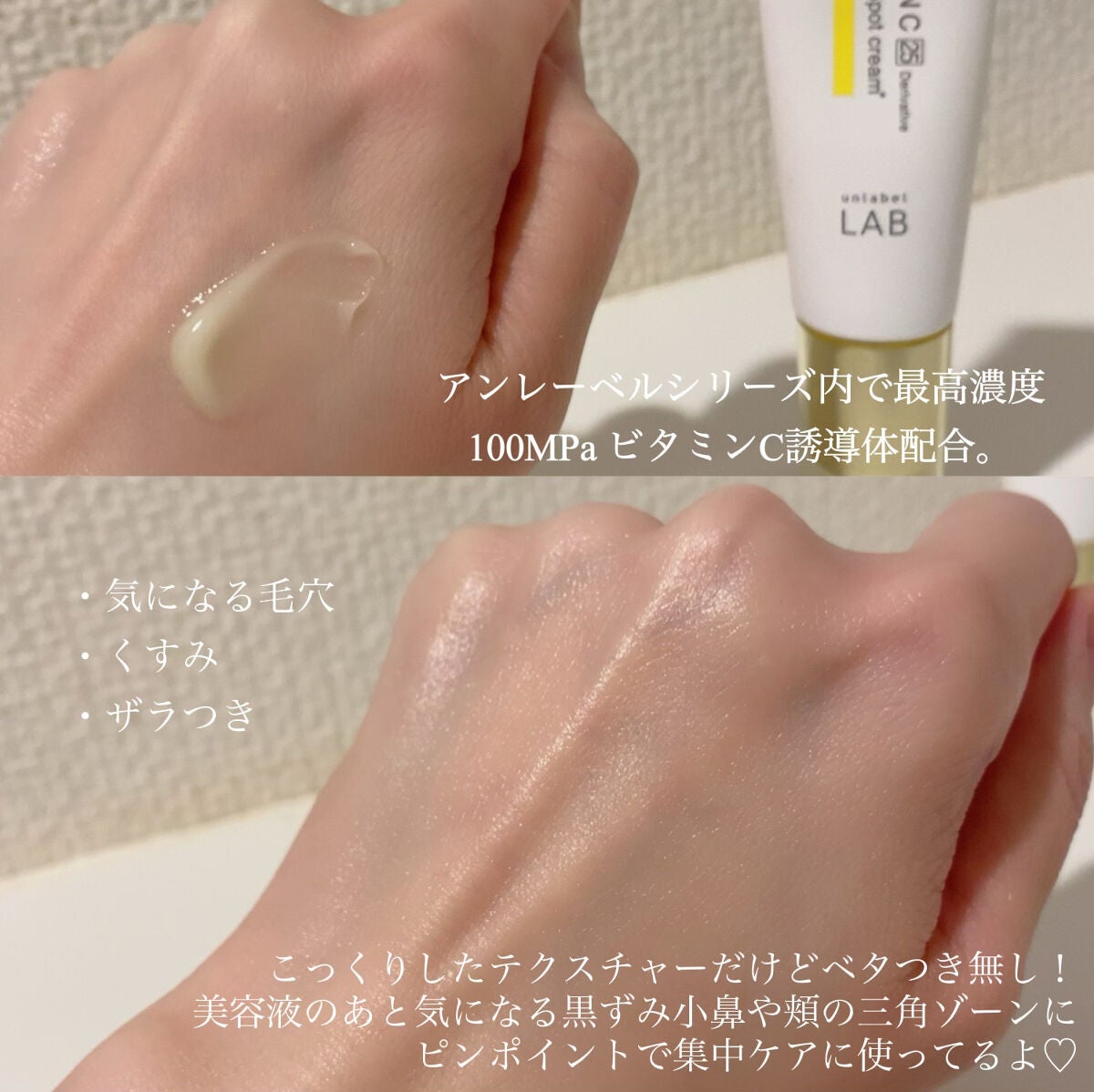 V スポットクリーム /unlabel/フェイスクリームを使ったクチコミ(2枚目)