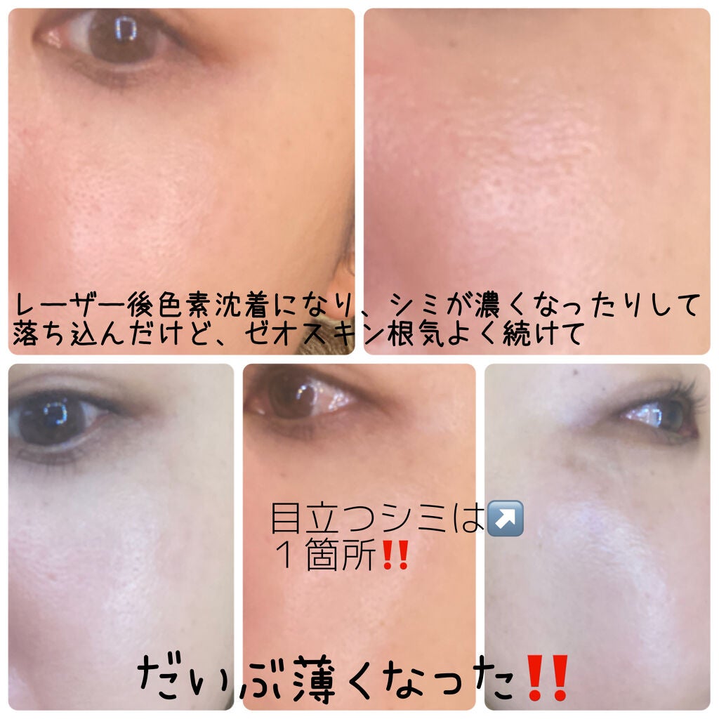 デイリーPD/ZO Skin Health/フェイスクリームを使ったクチコミ(9枚目)