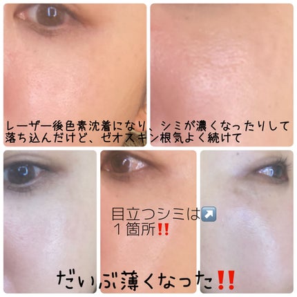 デイリーPD/ZO Skin Health/フェイスクリームを使ったクチコミ(9枚目)