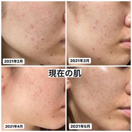 TK ローション/メナード/化粧水を使ったクチコミ(3枚目)