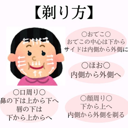 bi-hada ompa L ホルダー替刃2個付/貝印/シェーバーを使ったクチコミ(5枚目)