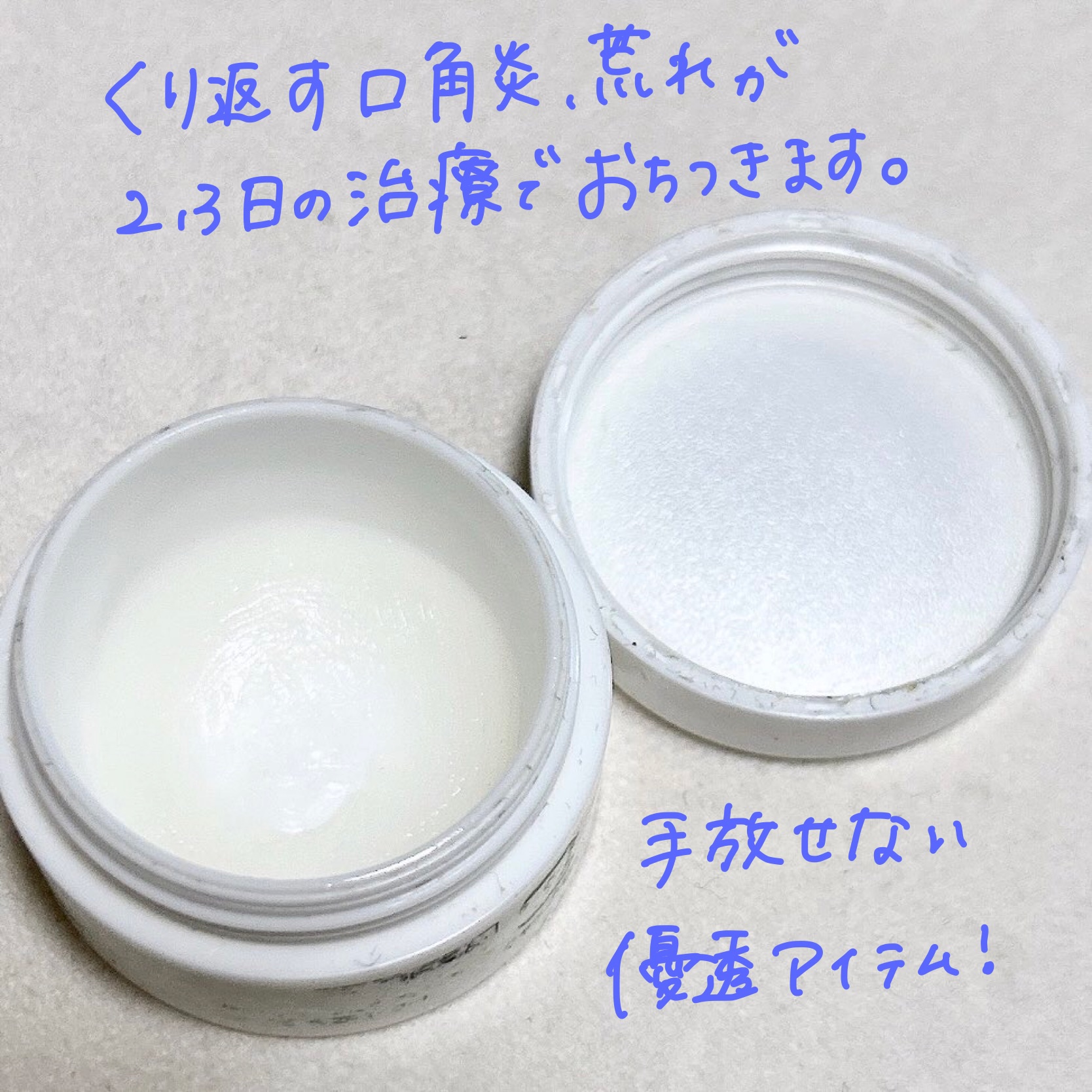 メディカルリップb(医薬品)/メンソレータム/その他を使ったクチコミ（3枚目）