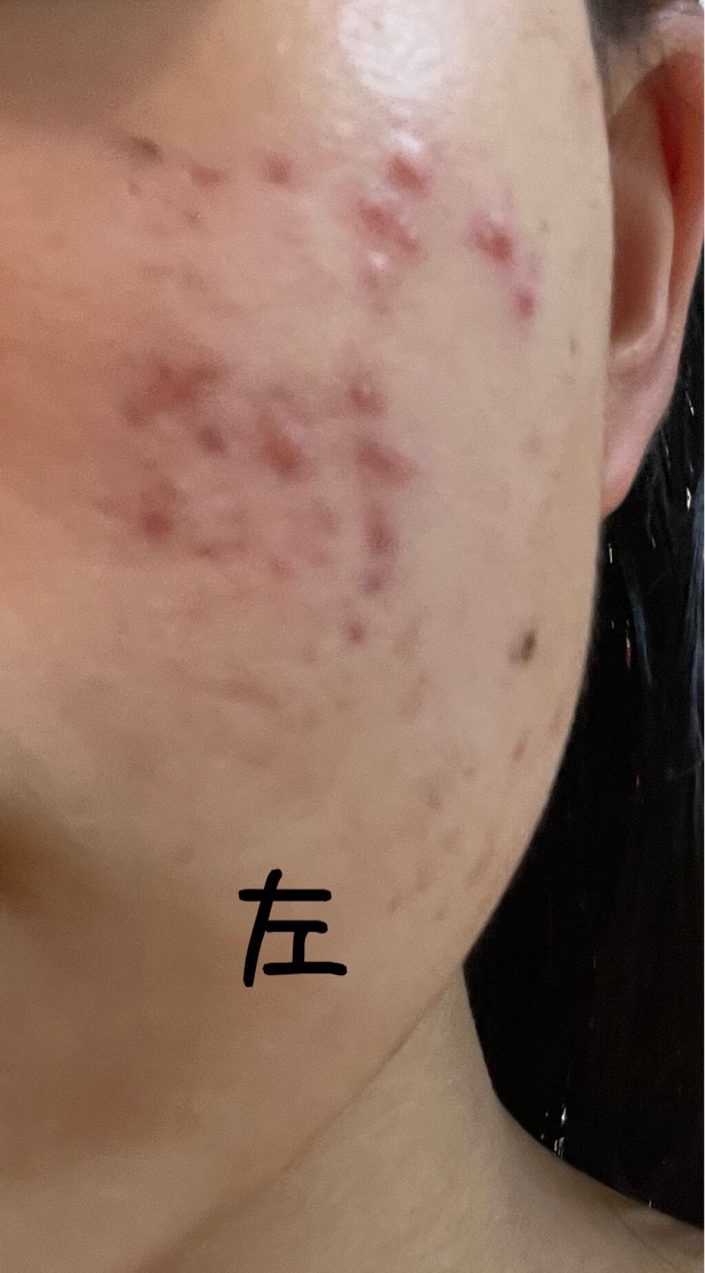 KINNGYOchanâð€ on LIPS ãã©ãã§ããããïŒâŠç®èç§ã«è¡ã£ãŠãããçšã®åç²§æ°Žè²°ã£ãŠé£²ãè¬ã..ãïŒ2æç®ïŒ