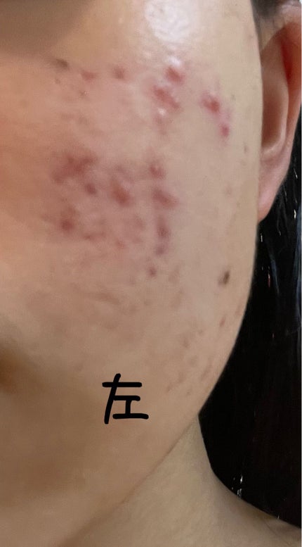 ã䜿ã£ãã¯ãã³ãïŒ2æç®ïŒ