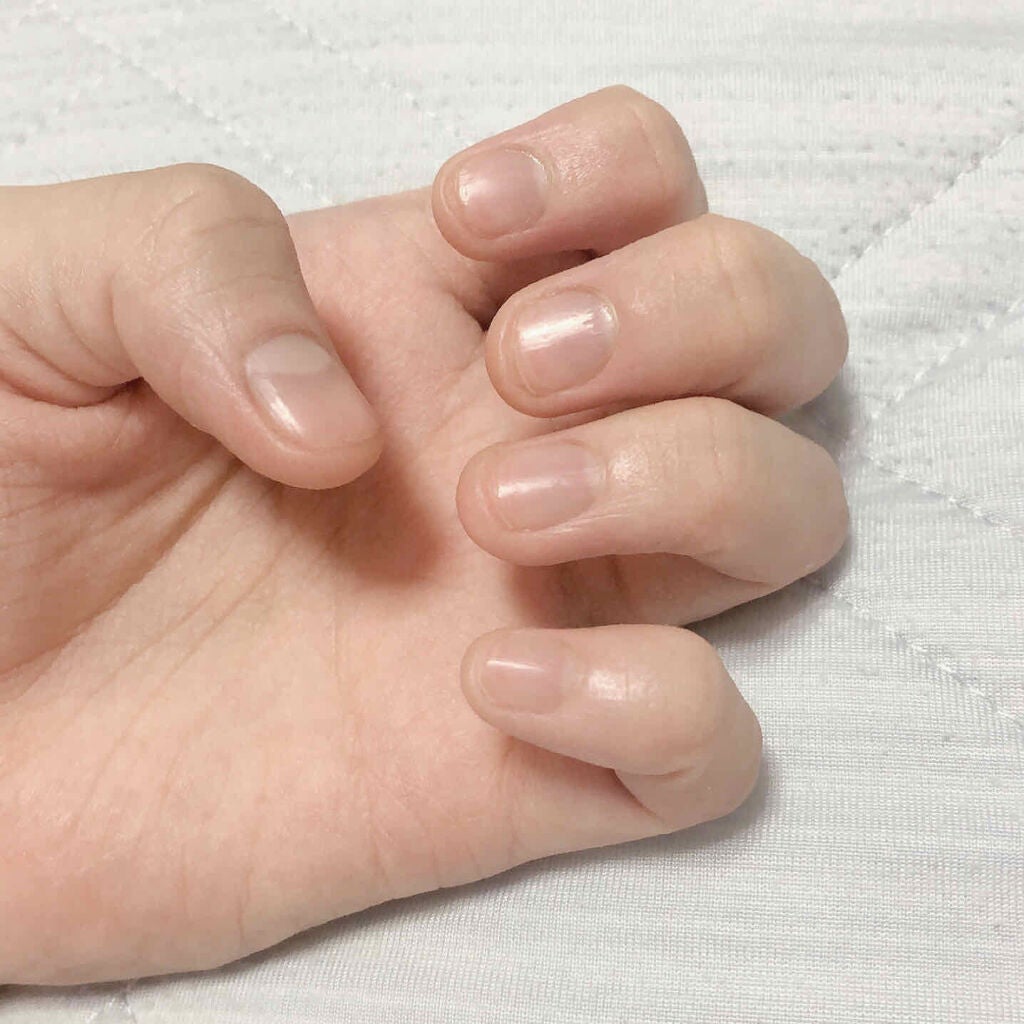 ウィンマックス キューティクルオイル/DAISO/ネイルオイル・トリートメントを使ったクチコミ(1枚目)