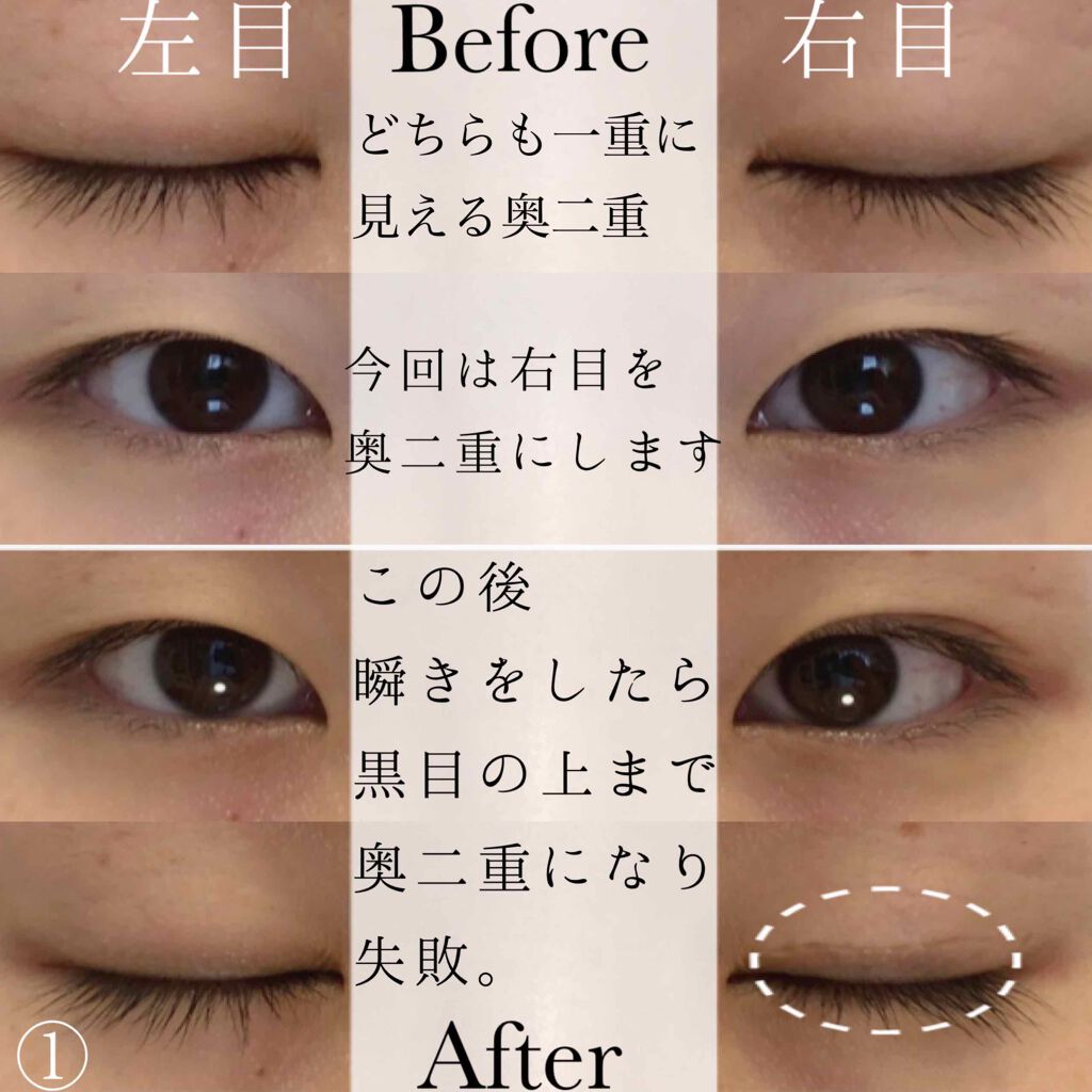 フリーファイバー120 スタンダードタイプ /メザイク/二重まぶた用アイテムを使ったクチコミ(5枚目)