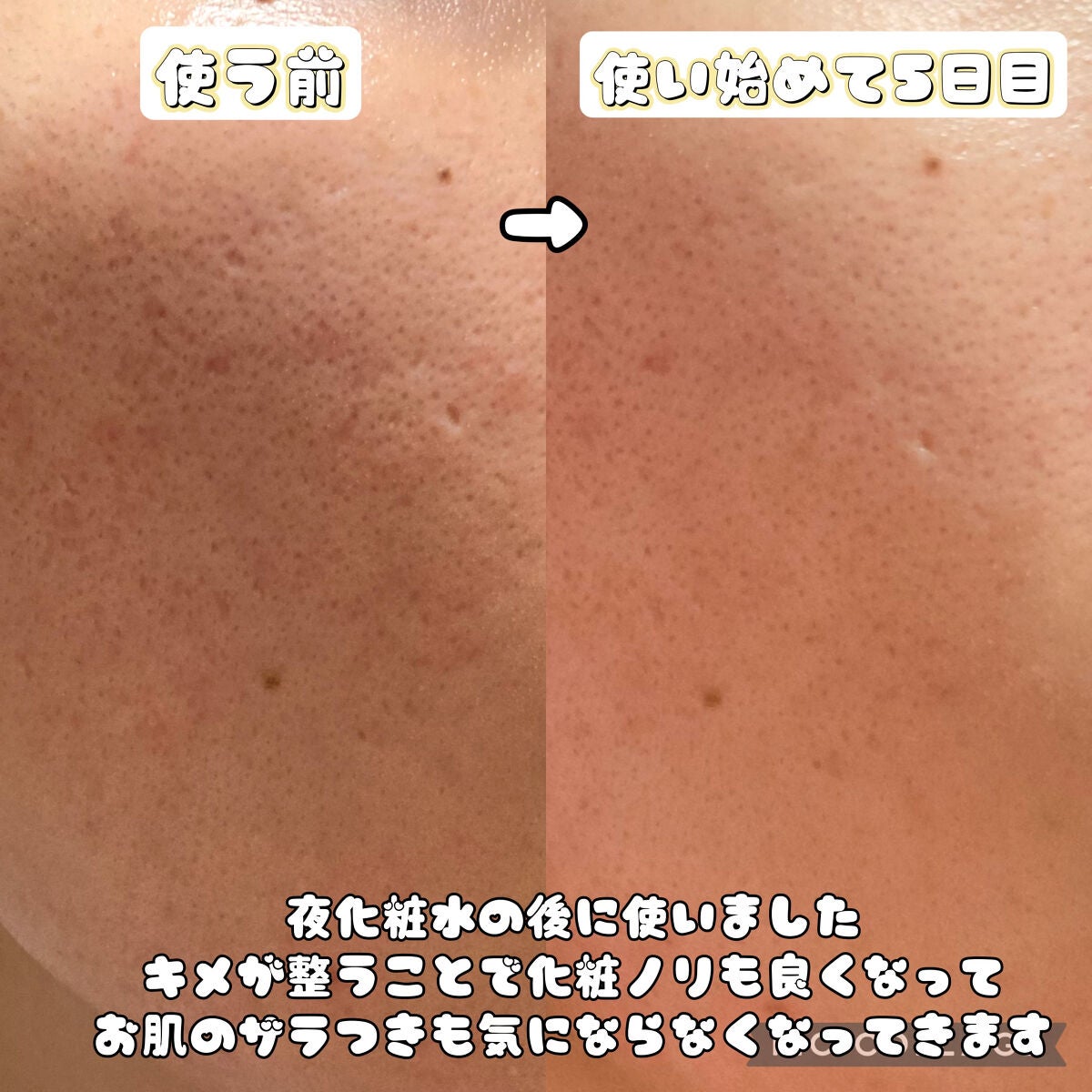 ã¶ãã¿ãã³C23/IOPE/çŸå®¹æ¶²ã䜿ã£ãã¯ãã³ãïŒ3æç®ïŒ