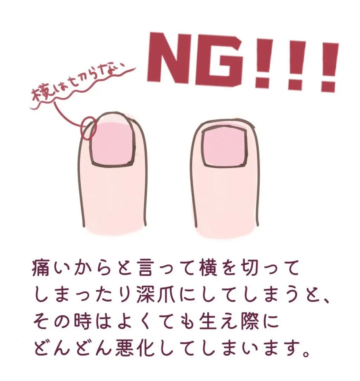 ジェルボリュームトップコート/キャンメイク/ネイルトップコートを使ったクチコミ(3枚目)