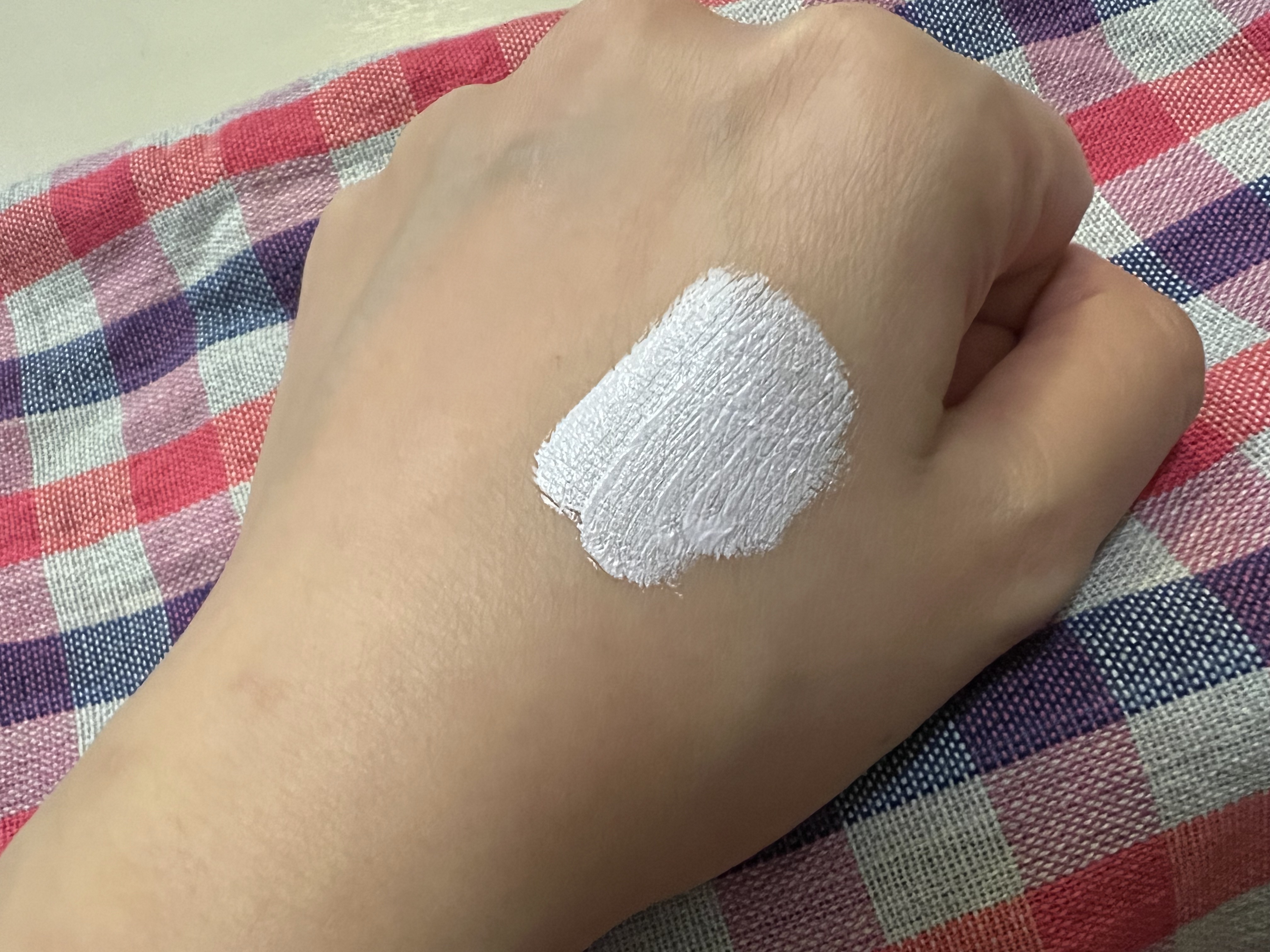 WHOMEE リキッドコンシーラーのクチコミ「転倒して顔面強打した際に頬骨周りに痣が出来てしまいました…

痣が青紫から黄色に変わった時、手.....」（2枚目）