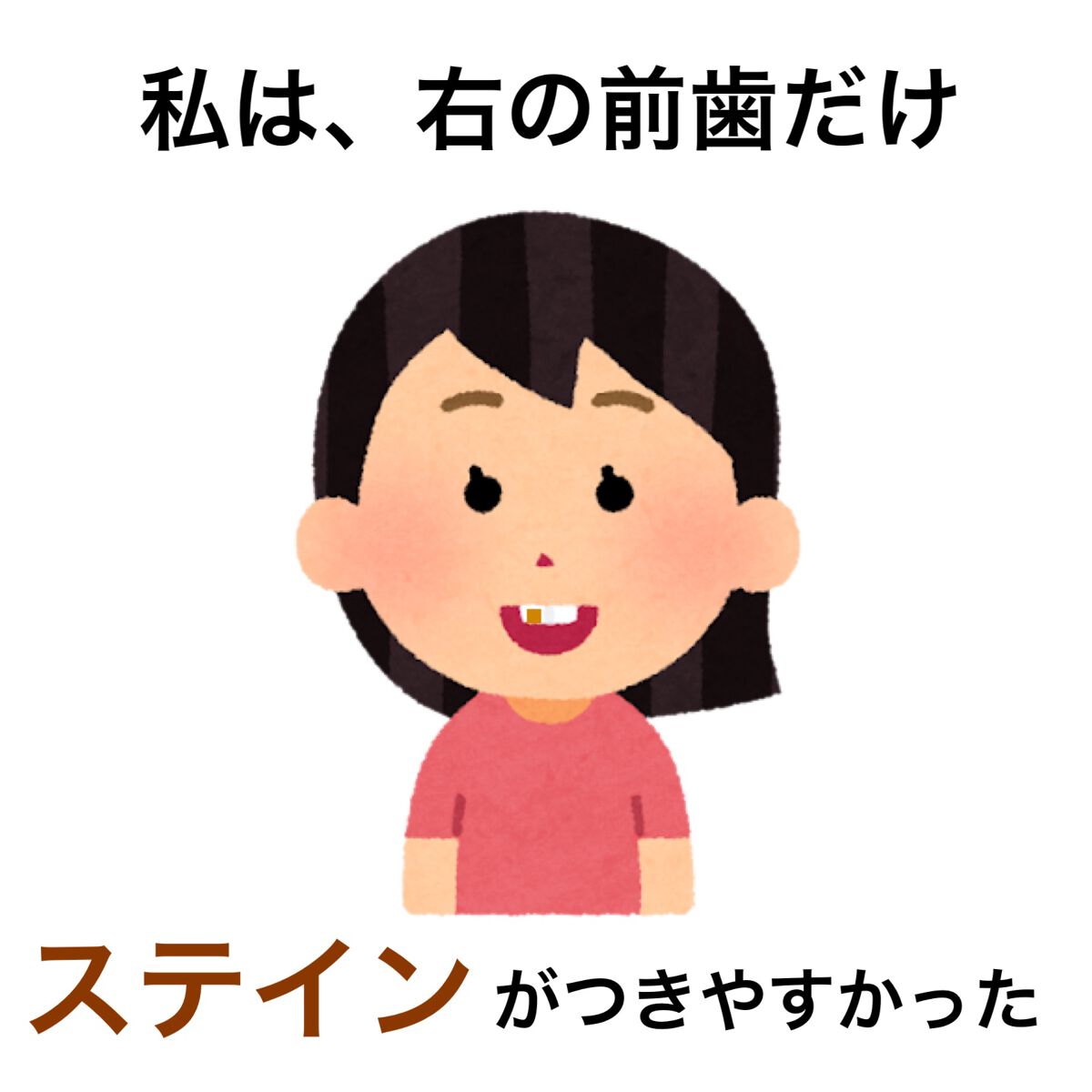 アパガードMプラス/アパガード/歯磨き粉を使ったクチコミ（3枚目）