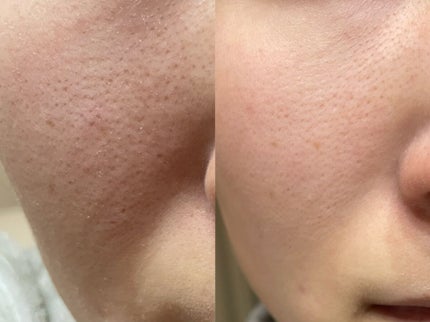 CICA デイリースージングマスク/VT/シートマスク・パックを使ったクチコミ(2枚目)