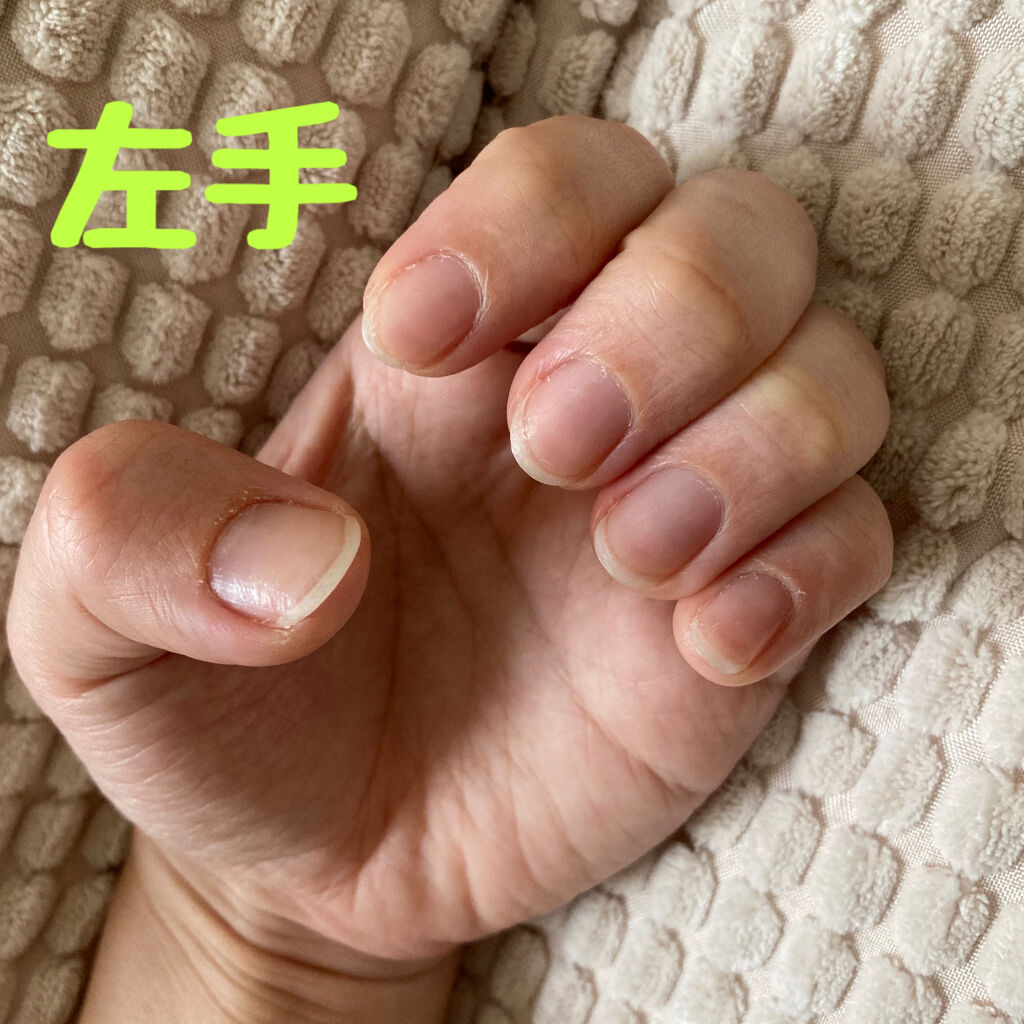 エテュセ クイックケアコート/ettusais/ネイルオイル・トリートメントを使ったクチコミ（3枚目）