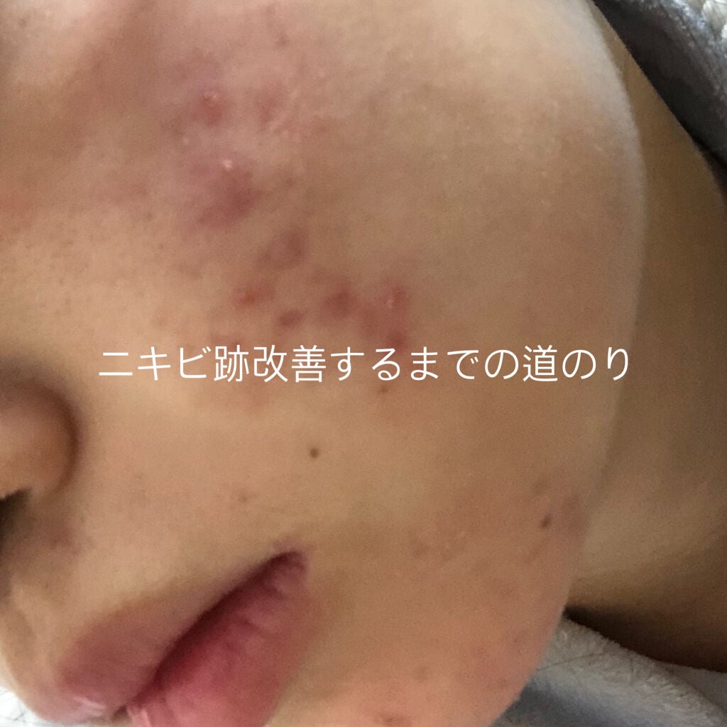 潤浸保湿 フェイスクリーム/キュレル/フェイスクリームを使ったクチコミ(1枚目)