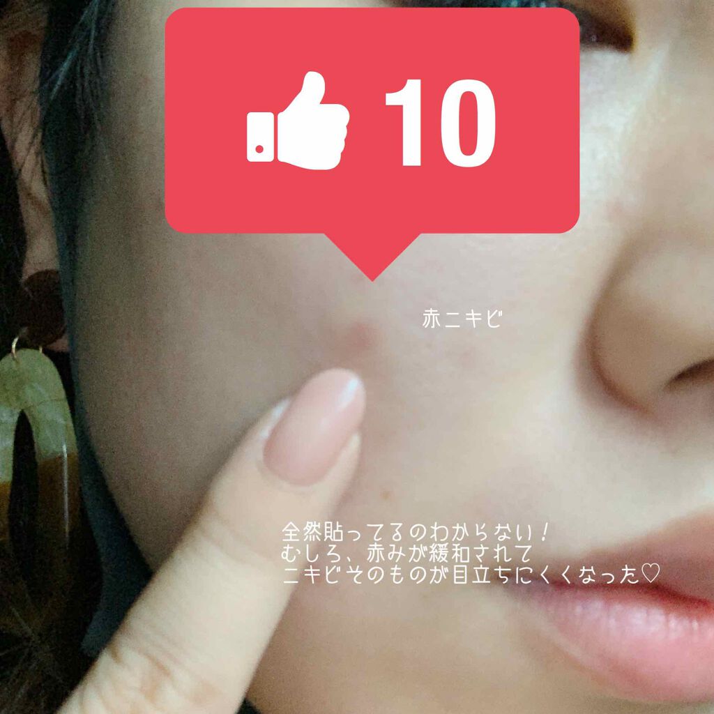 ゼロスポットパッチ/Today’s Cosme/にきびパッチを使ったクチコミ(2枚目)