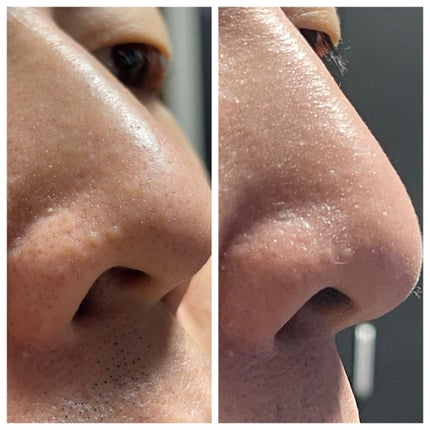 ソフィーナ iP ポア クリアリング ジェル ウォッシュ/SOFINA iP/その他洗顔料を使ったクチコミ(2枚目)