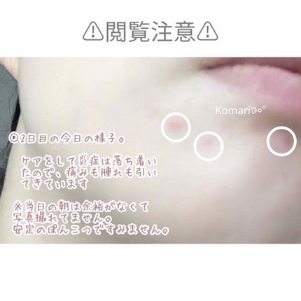 うるおい浸透マスクAD (アクネ)(旧)/肌美精/シートマスク・パックを使ったクチコミ(4枚目)