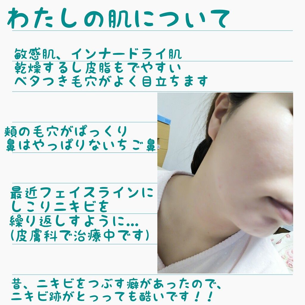 美白乳液 W/ちふれ/乳液を使ったクチコミ(2枚目)