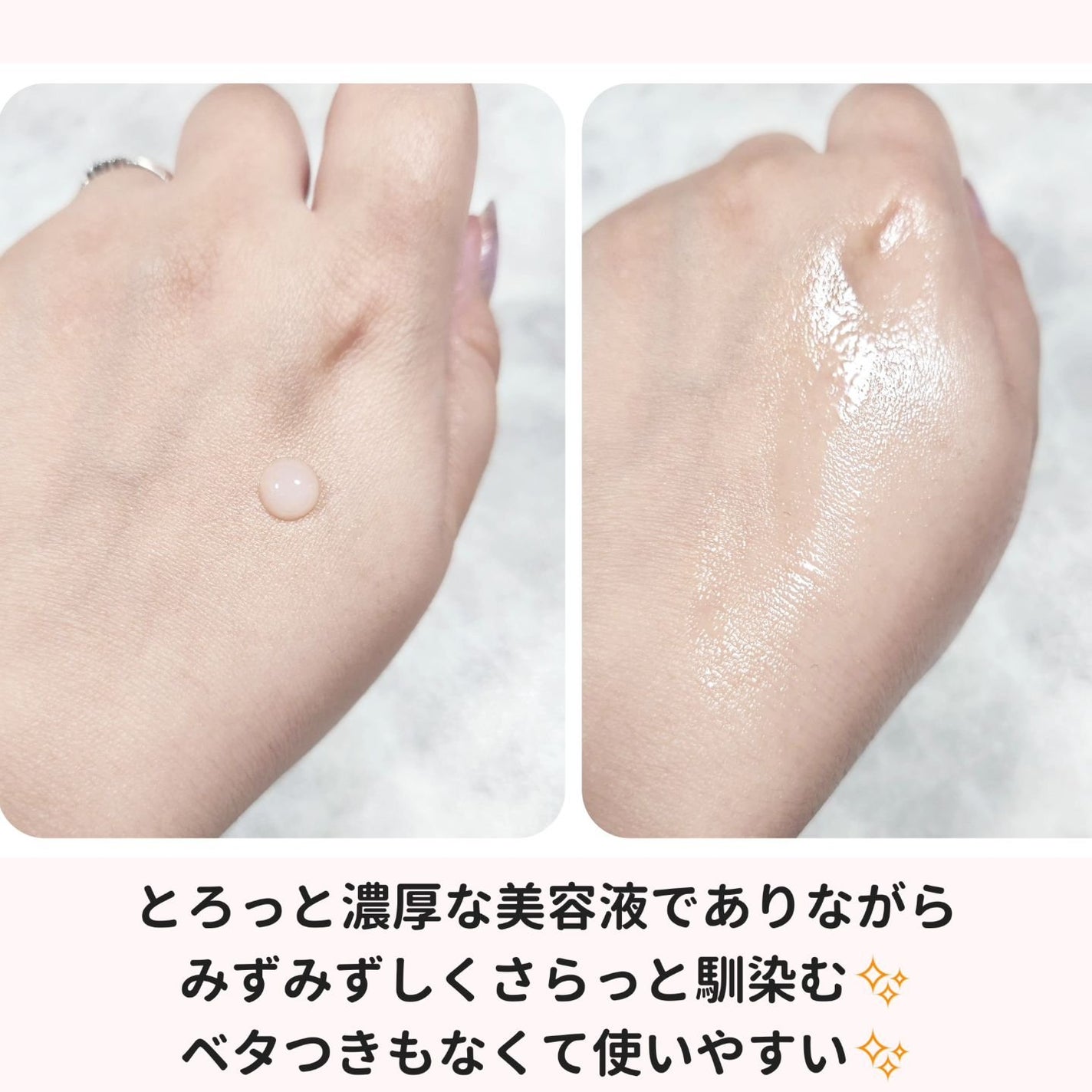 エイシカ365マイクロセラム/AESTURA/美容液を使ったクチコミ(4枚目)