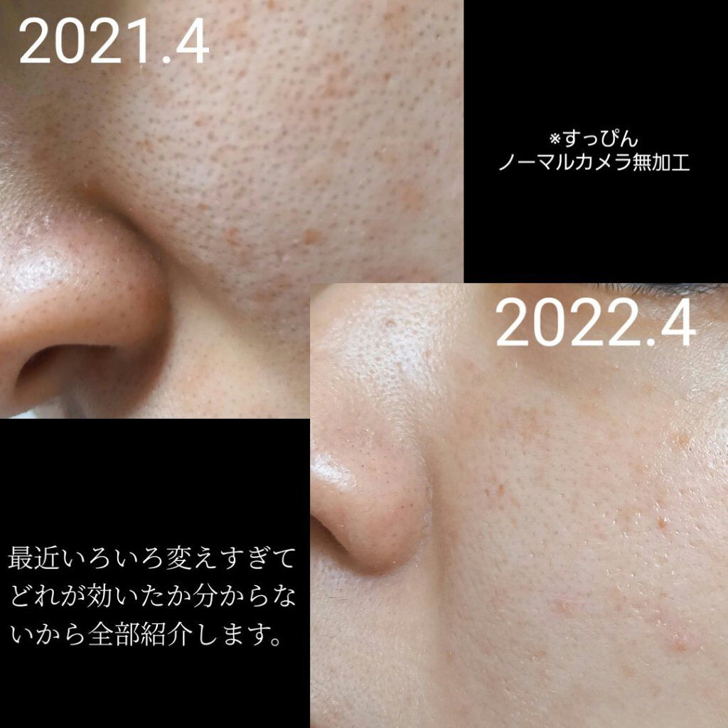 ビタミンC/Dear-Natura (ディアナチュラ)/健康サプリメントを使ったクチコミ（1枚目）