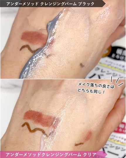 クレンジングバーム ブラック/アンダーメソッド/クレンジングバームを使ったクチコミ(5枚目)