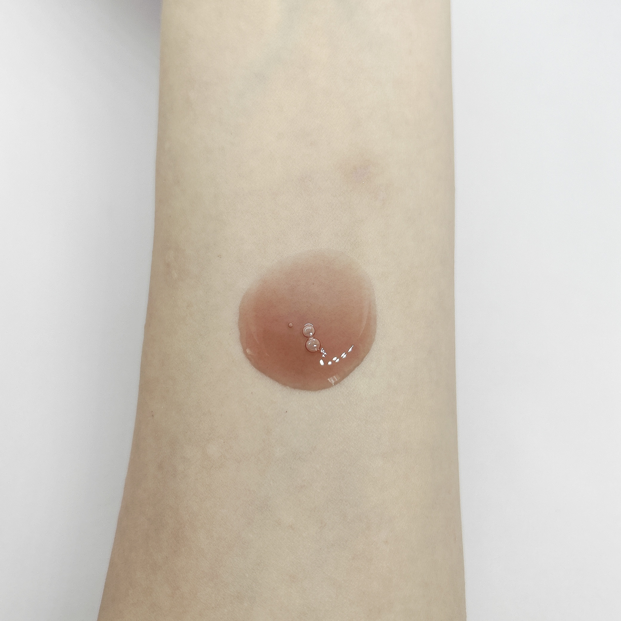 mgb skin レッドピールのクチコミ「MEGOOD BEAUTYさまからいただきました
mgb skin
RED PEEL
洗い流す.....」（3枚目）