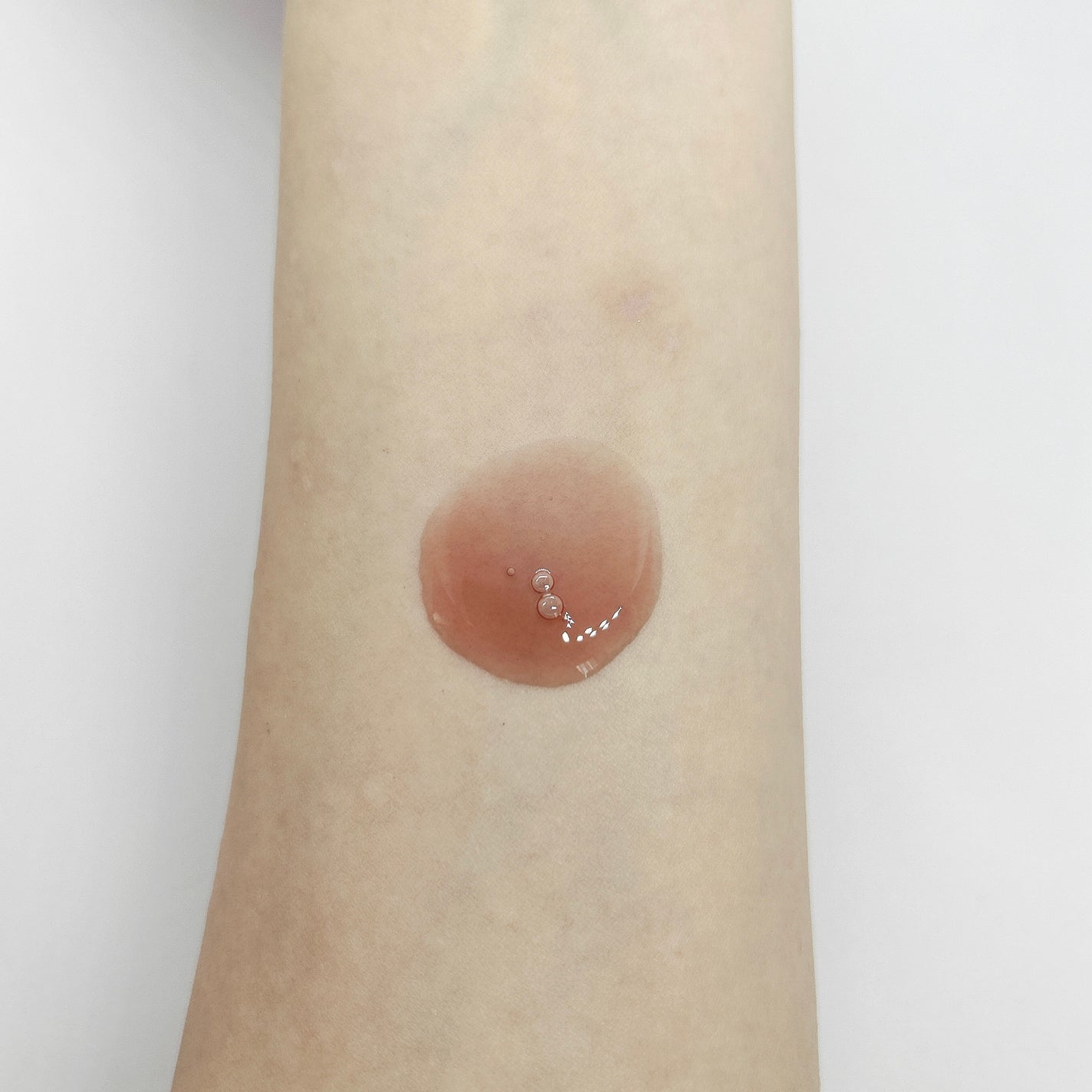 レッドピール/mgb skin/ピーリングを使ったクチコミ(3枚目)