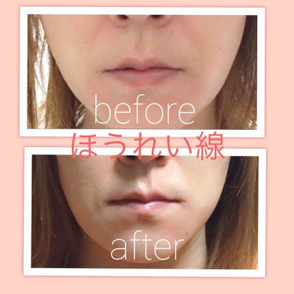 7 day Special Set プログラム2/b.glen/トライアルキットを使ったクチコミ(3枚目)