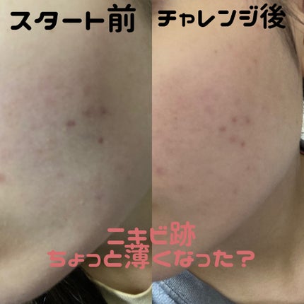 CICA クリーム/VT/フェイスクリームを使ったクチコミ(6枚目)