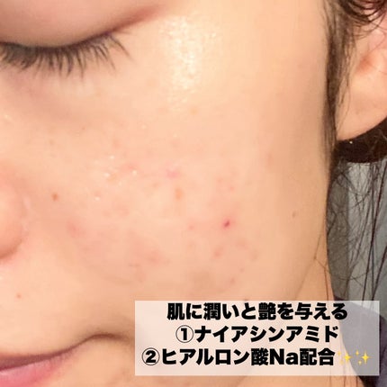 シカルファットプラス リペアミルク/アベンヌ/乳液を使ったクチコミ(3枚目)