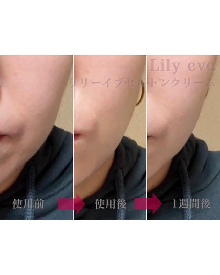 セルターンクリーム 100ml/リリーイブ/フェイスクリームを使ったクチコミ(4枚目)