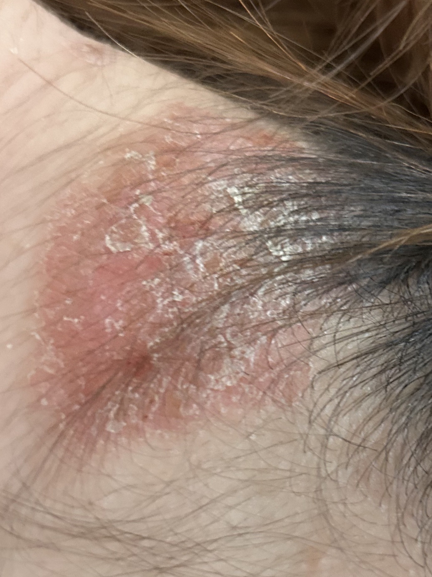 プレミアム ボンドメンテシャンプー／ボンドメンテトリートメント シャンプー本体 460ml/IONICO/市販シャンプーを使ったクチコミ（3枚目）