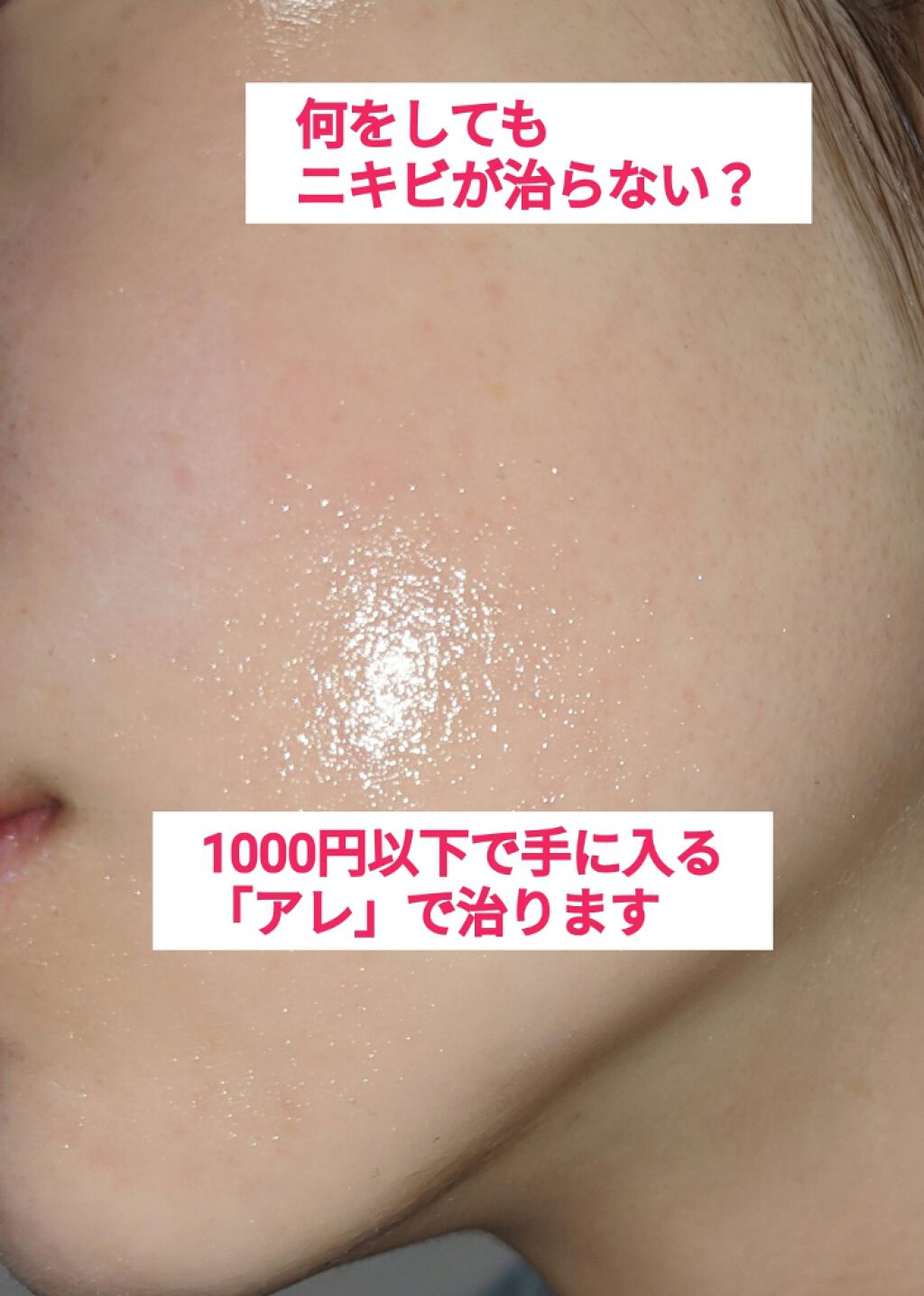 ハトムギ化粧水(ナチュリエ スキンコンディショナー R )/ナチュリエ/化粧水を使ったクチコミ（1枚目）