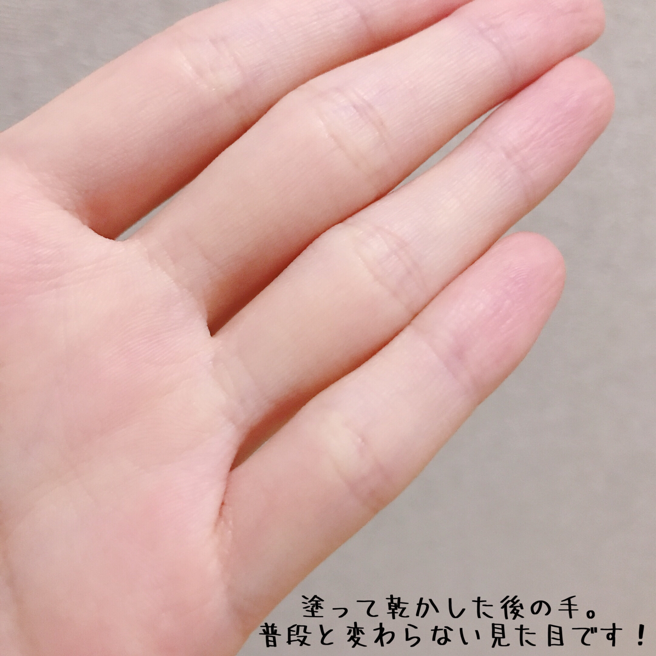 プロテクトフォームP/syante/その他を使ったクチコミ（3枚目）