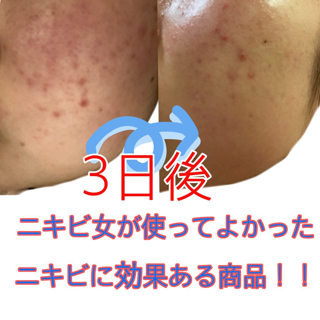 薬用しみ対策 美白化粧水/メラノCC/化粧水を使ったクチコミ(1枚目)