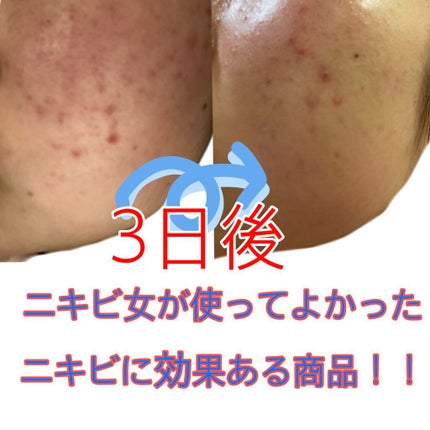 薬用しみ対策 美白化粧水/メラノCC/化粧水を使ったクチコミ(1枚目)