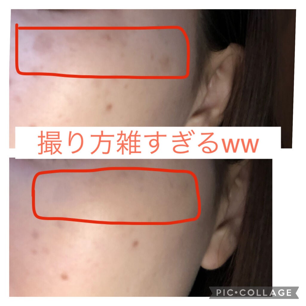 スティックコンシーラーA/KATE/スティックコンシーラーを使ったクチコミ(3枚目)